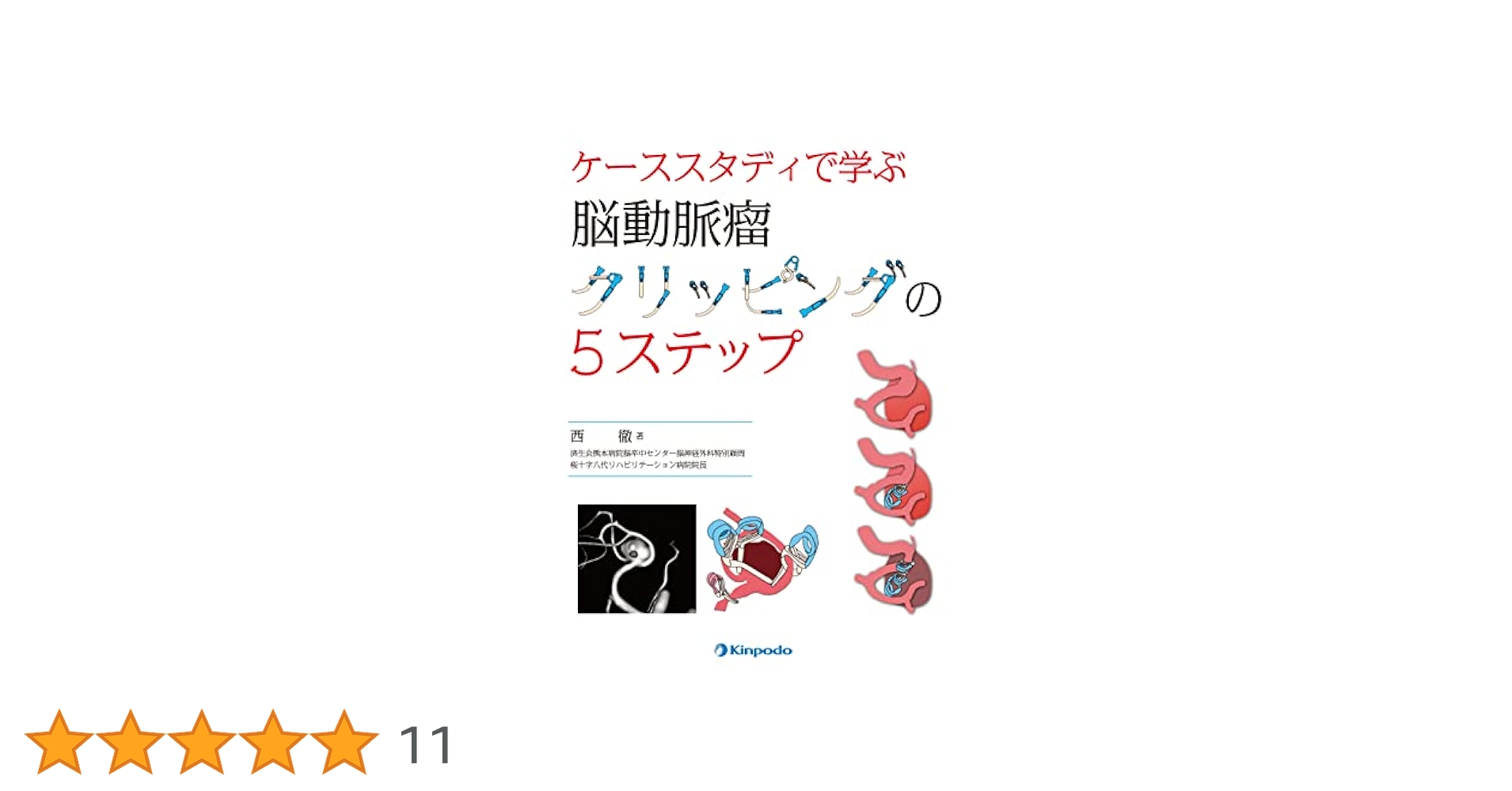 ケーススタディで学ぶ脳動脈瘤クリッピングの5ステップ ケーススタディで学ぶ 脳動脈瘤クリッピングの5ステップ | 西 徹